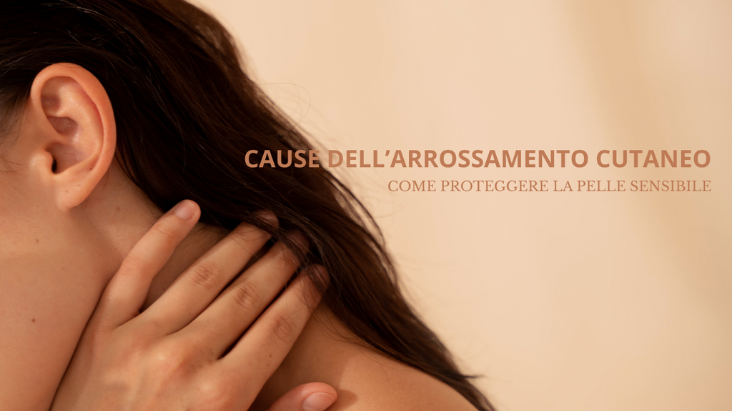 Pelle Arrossata: Cosa Fare Subito per Calmarla in Modo Naturale