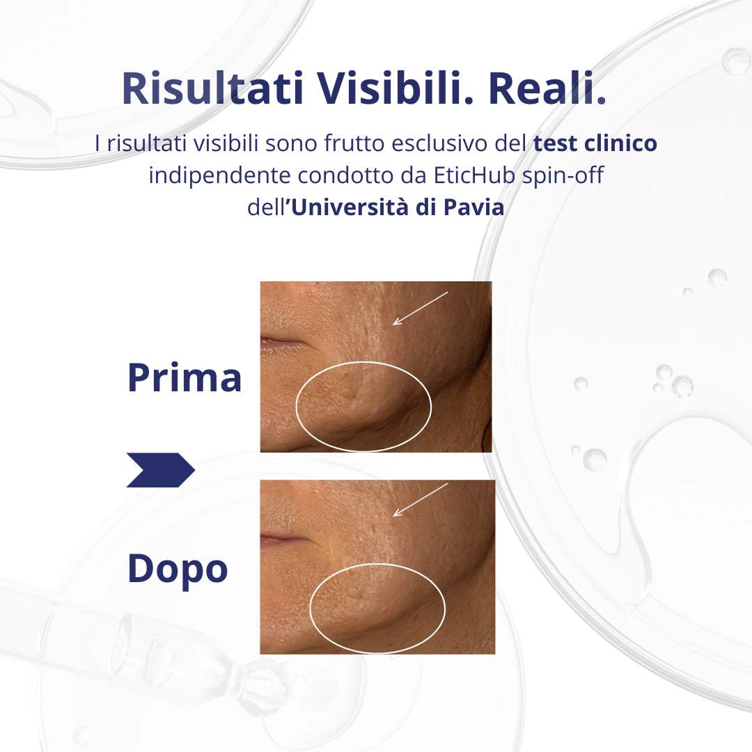 Alba LeLang: pelle prima e dopo l'uso della crema rassodante
