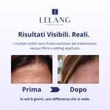 MULTI PEPTIDE LIFT FORMULA - BOTOXIL TECHNOLOGY