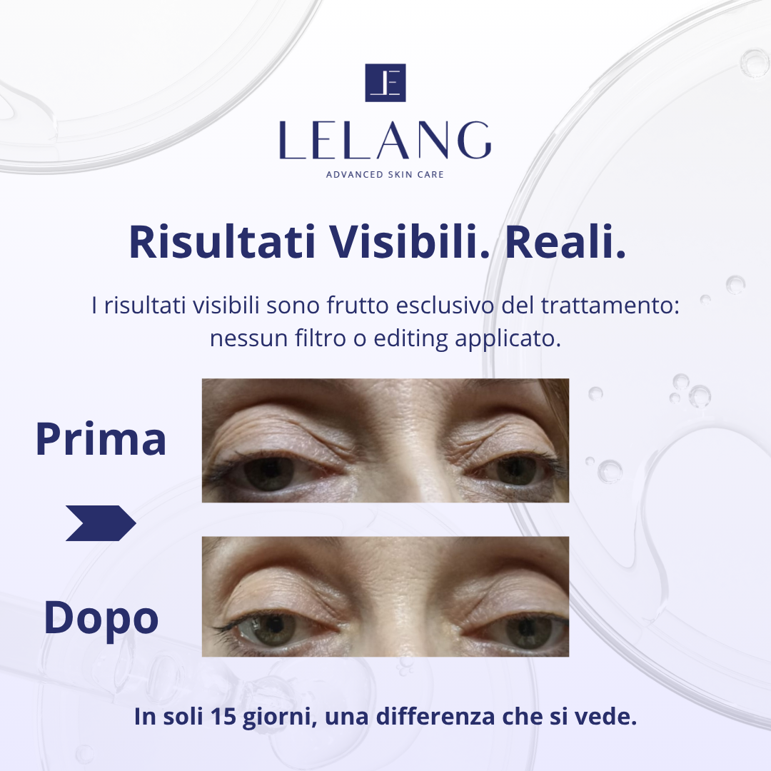 Formula Eyes Duo Peptide LeLang: contorno occhi prima e dopo 15 giorni